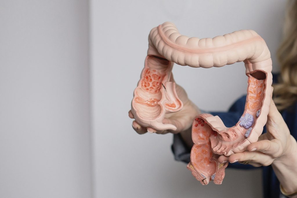 Anatomisch model van darm vastgehouden door orthomoleculair darmtherapeut van Mind Your Gut
