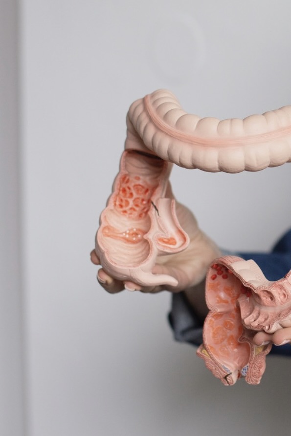 Close up anatomisch model van dikke darm 